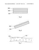 Implantable Devices That Generate Low Intensity Electric Fields For The     Treatment of Atherosclerotic Disease And Prevention of Ischemic Vascular     Events and Methods of Manufacture diagram and image