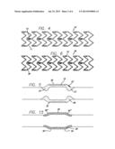 DRUG-ELUTING STENT AND DELIVERY SYSTEM WITH TAPERED STENT IN SHOULDER     REGION diagram and image