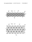 DRUG-ELUTING STENT AND DELIVERY SYSTEM WITH TAPERED STENT IN SHOULDER     REGION diagram and image