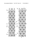 DRUG-ELUTING STENT AND DELIVERY SYSTEM WITH TAPERED STENT IN SHOULDER     REGION diagram and image