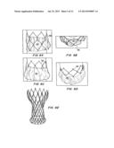 MEANS FOR CONTROLLED SEALING OF ENDOVASCULAR DEVICES diagram and image