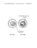 MEANS FOR CONTROLLED SEALING OF ENDOVASCULAR DEVICES diagram and image