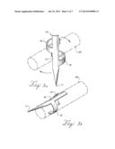 BARBED ANCHORS FOR WIRE STENT diagram and image