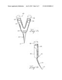 BARBED ANCHORS FOR WIRE STENT diagram and image