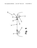 RIM ANCHORING SYSTEMS FOR FLEXIBLE SURGICAL IMPLANTS FOR REPLACING     CARTILAGE diagram and image