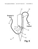 RIM ANCHORING SYSTEMS FOR FLEXIBLE SURGICAL IMPLANTS FOR REPLACING     CARTILAGE diagram and image