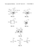 METHOD AND SYSTEM FOR ALIGNING A PROSTHESIS DURING SURGERY diagram and image