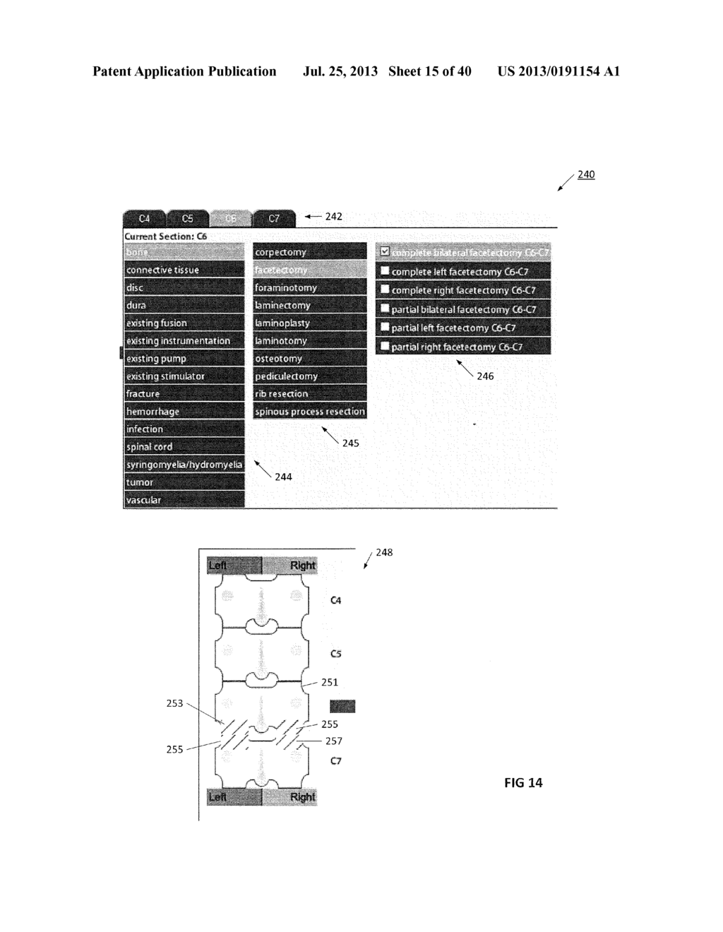 MEDICAL DATA SYSTEM GENERATING AUTOMATED SURGICAL REPORTS - diagram, schematic, and image 16