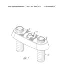 Fluid Delivery Assembly (1-In, Combined with Centering Stop) diagram and image