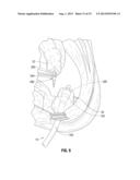 Circular Stapler Including Buttress diagram and image