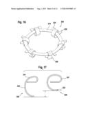 CONICAL SPRING WASHER FOR MOUNTING A STATOR IN THE HOUSING OF AN     ELECTRICAL MACHINE diagram and image