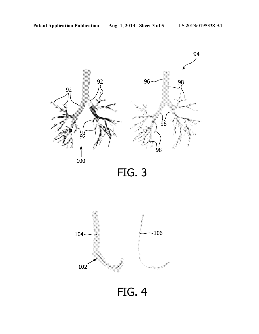 INSTRUMENT-BASED IMAGE REGISTRATION FOR FUSING IMAGES WITH TUBULAR     STRUCTURES - diagram, schematic, and image 04