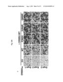 ERBB3 Mutations In Cancer diagram and image