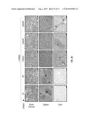 ERBB3 Mutations In Cancer diagram and image