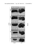 ERBB3 Mutations In Cancer diagram and image