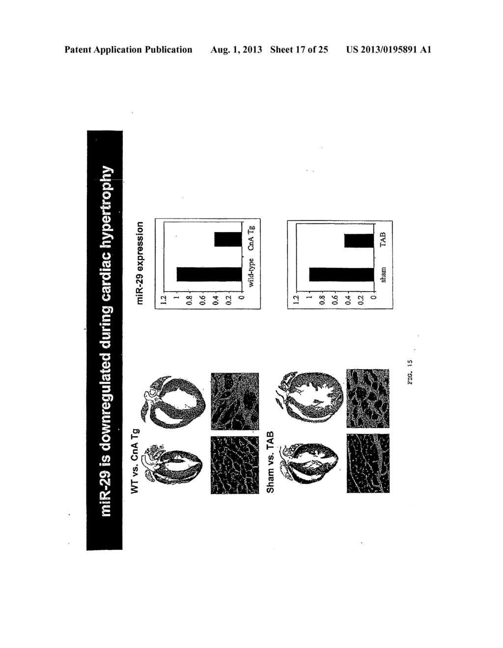 Micro-RNA family that Modulates Fibrosis and Uses Thereof - diagram, schematic, and image 18