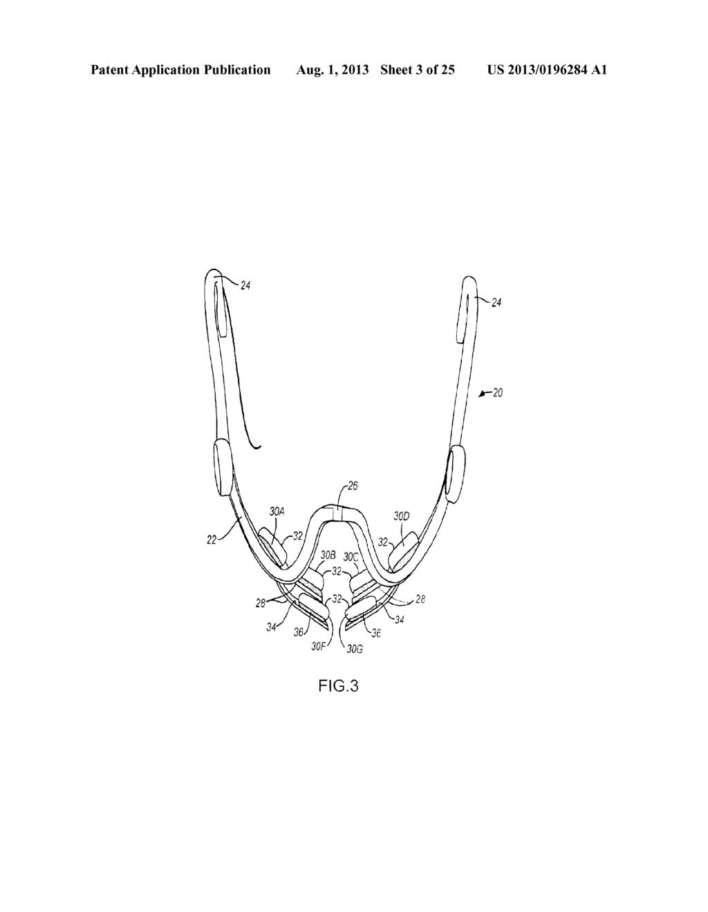 METHOD AND APPARATUS FOR TOOTH REGULATION WITH HEAVY FORCES - diagram, schematic, and image 04