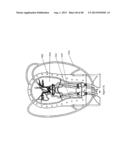 Cardiac Simulation Device diagram and image