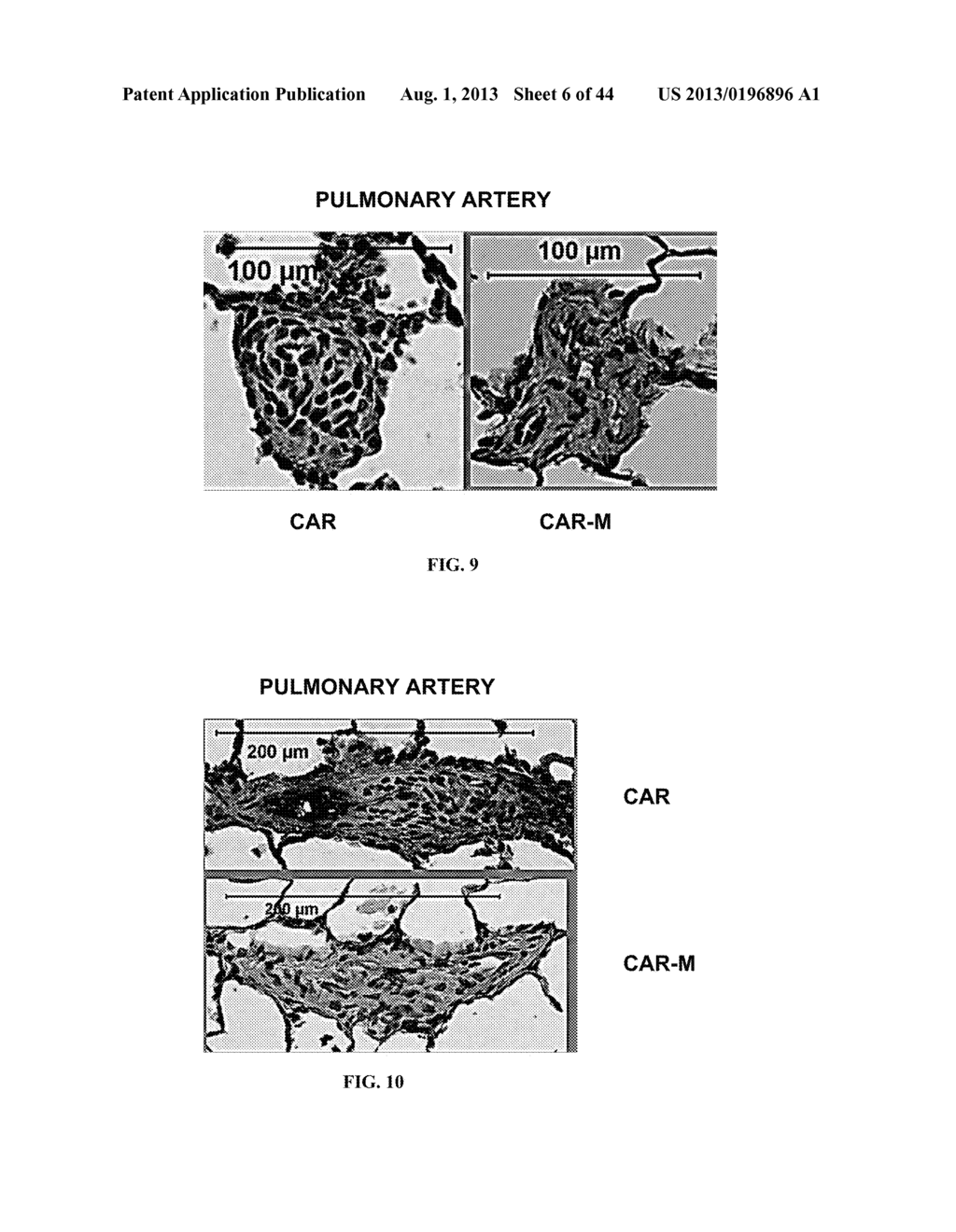 CAR PEPTIDE FOR HOMING, DIAGNOSIS & TARGETED THERAPY FOR PULMONARY AND     FIBROTIC DISORDERS - diagram, schematic, and image 07