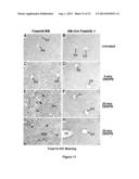 Methods and Compositions Inhibiting Tumor Cell Proliferation diagram and image