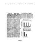 Methods and Compositions Inhibiting Tumor Cell Proliferation diagram and image