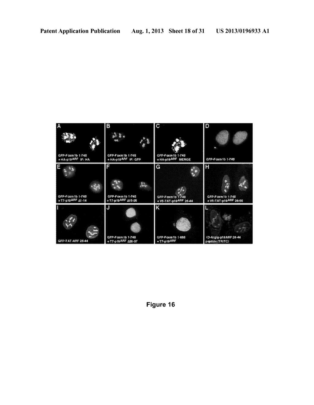 Methods and Compositions Inhibiting Tumor Cell Proliferation - diagram, schematic, and image 19