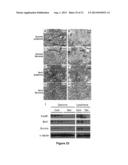 Methods and Compositions Inhibiting Tumor Cell Proliferation diagram and image