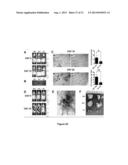 Methods and Compositions Inhibiting Tumor Cell Proliferation diagram and image