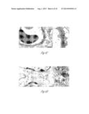 N-ACETYL MANNOSAMINE AS A THERAPEUTIC AGENT diagram and image