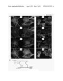 METHOD FOR REDUCING EXPRESSION OF DOWNREGULATED IN RENAL CELL CARCINOMA IN     MALIGNANT GLIOMAS diagram and image