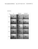 METHOD FOR REDUCING EXPRESSION OF DOWNREGULATED IN RENAL CELL CARCINOMA IN     MALIGNANT GLIOMAS diagram and image