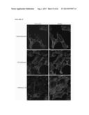 METHOD FOR REDUCING EXPRESSION OF DOWNREGULATED IN RENAL CELL CARCINOMA IN     MALIGNANT GLIOMAS diagram and image