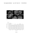 MICRORNA PATTERNS FOR THE DIAGNOSIS, PROGNOSIS AND TREATMENT OF MELANOMA diagram and image