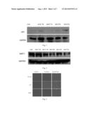 USE OF ADRENERGIC BETA-3-RECEPTOR AGONISTS IN ANTI-AGING diagram and image