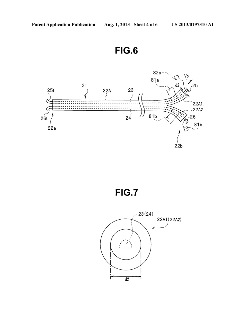 Intracorporeal insertion instrument - diagram, schematic, and image 05