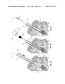 ENDOSCOPIC PORTS FOR MINIMALLY INVASIVE SURGICAL ACCESS AND METHODS OF USE     THEREOF diagram and image