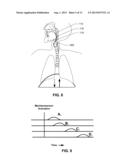 NEURAL MONITORING METHODS AND SYSTEMS FOR TREATING UPPER AIRWAY DISORDERS diagram and image