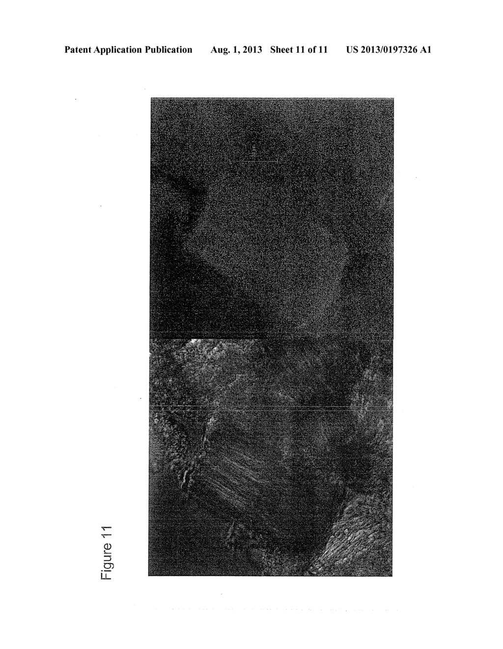 Compositions And Methods For Measurement of Analytes - diagram, schematic, and image 12