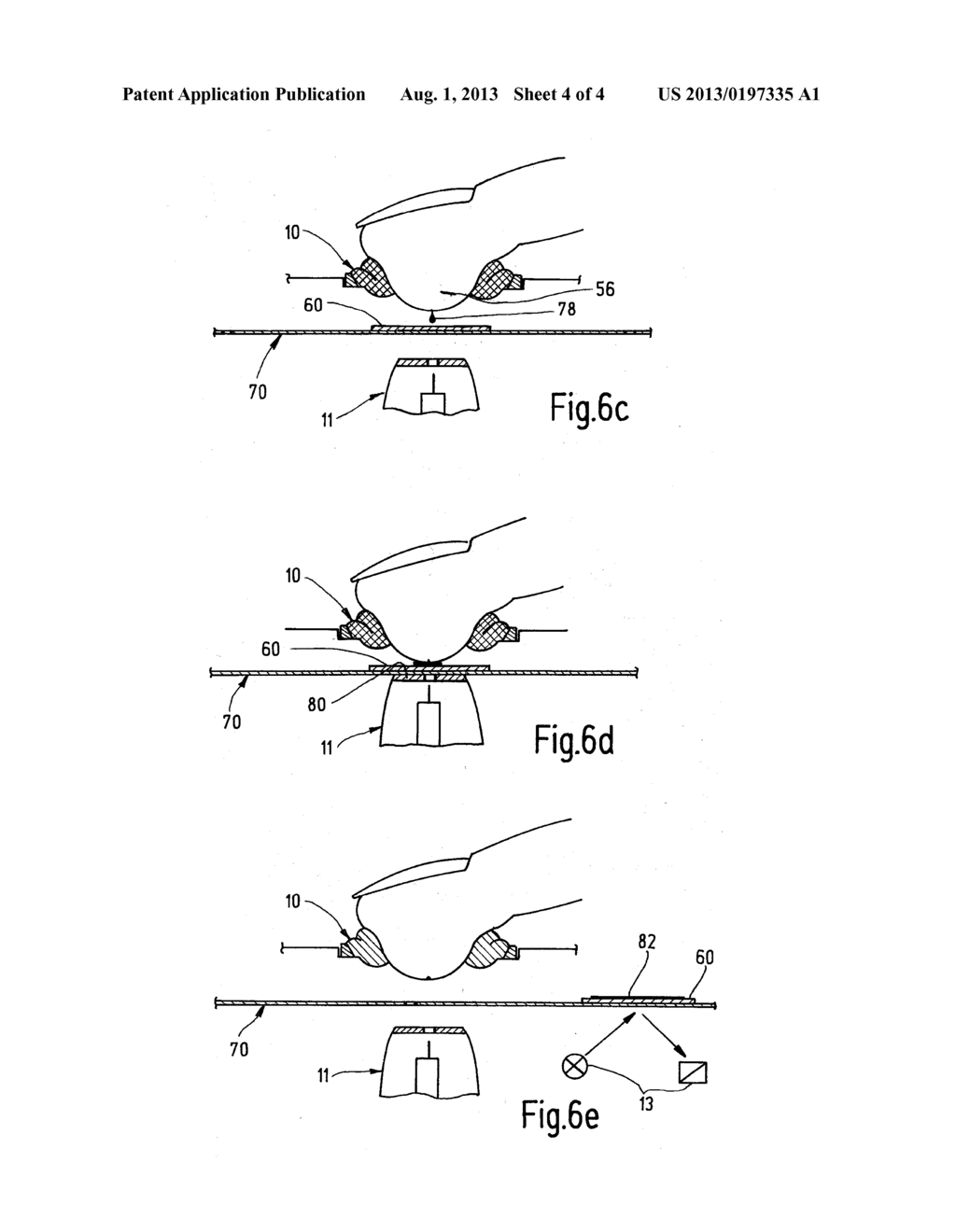 DEVICE AND METHOD FOR POSITIONING A BODY PART FOR FLUID ANALYSIS - diagram, schematic, and image 05