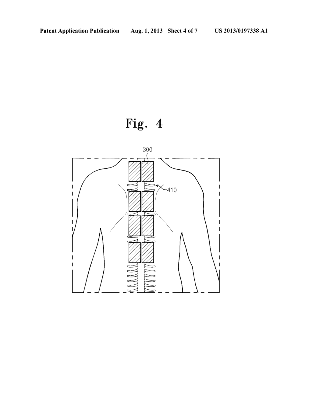 PAIN SIGNAL MEASUREMENT DEVICE AND PAIN SIGNAL MEASURING AND CONTROLLING     METHOD THEREOF - diagram, schematic, and image 05