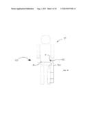 Potential Artery-to-Vein Disease State Detection diagram and image