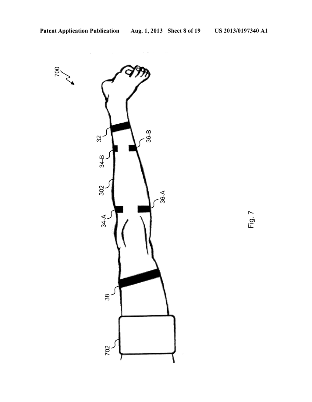 Potential Artery-to-Vein Disease State Detection - diagram, schematic, and image 09