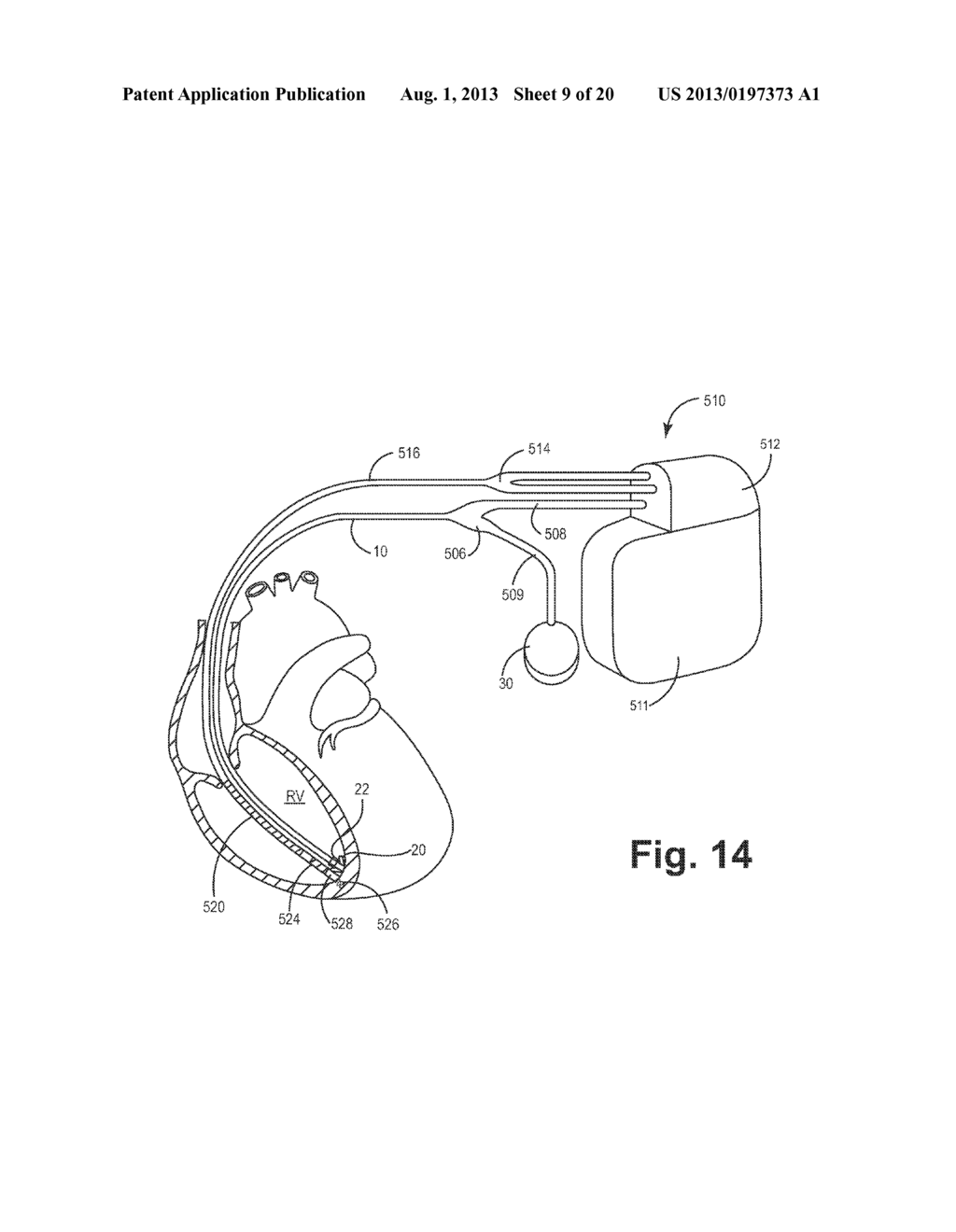 IMPLANTABLE MEDICAL DEVICE HAVING OPTICAL FIBER FOR SENSING ELECTRICAL     ACTIVITY - diagram, schematic, and image 10