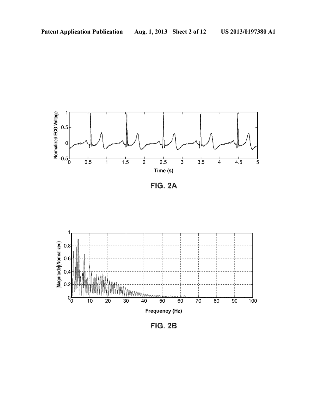 Atrial Fibrillation Classification Using Power Measurement - diagram, schematic, and image 03
