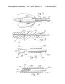 METHODS AND DEVICES FOR BIOPSY AND COLLECTION OF SOFT TISSUE diagram and image