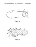 SPRING ORTHOTIC DEVICE diagram and image