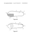 SPRING ORTHOTIC DEVICE diagram and image