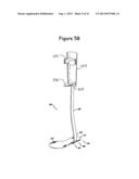 SPRING ORTHOTIC DEVICE diagram and image