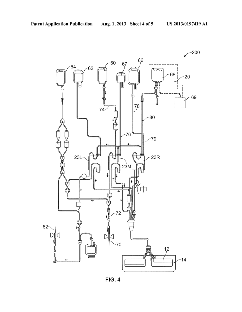 SYSTEMS AND METHODS FOR PERFORMING ONLINE EXTRACORPOREAL PHOTOPHERESIS - diagram, schematic, and image 05