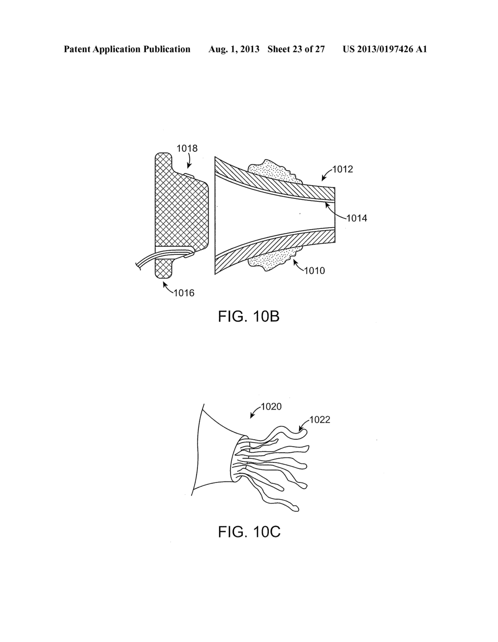 SYSTEMS AND METHODS FOR ANESTHETIZING EAR TISSUE - diagram, schematic, and image 24